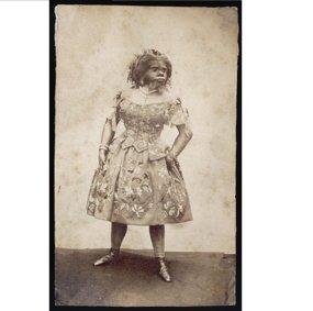 Julia Pastrana - bilde i sort-hvitt