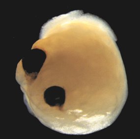 Eit hjerneorganoid - ein gul klump med to svarte prikkar i