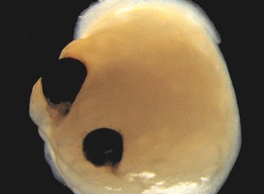 Eit hjerneorganoid - ein gul klump med to svarte prikkar i
